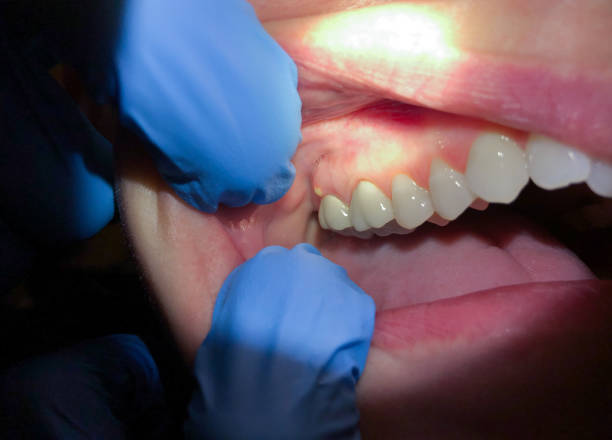 Best Emergency Treatment for Jaw Pain or Injury in West Hurley, NY