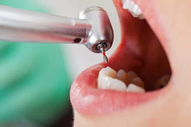 Best Emergency Denture Repair in West Hurley, NY